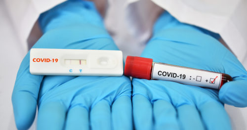PCR与COVID-19快速检测:有什么区别?